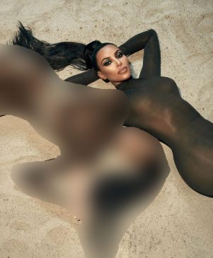 Vitiligo Brown Queen & Kim Kardashian Sexy (10 Photos)